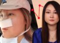 I Got Plastic Surgery And I Regret It
