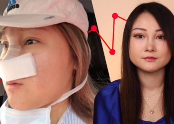 I Got Plastic Surgery And I Regret It