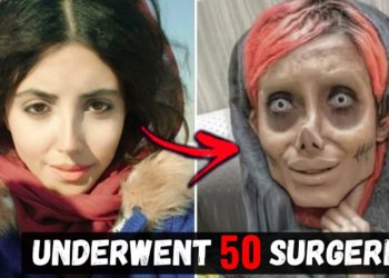 Unusual People Who Took Plastic Surgery Too Far…