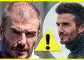David Beckham Hair Transplant (UN)CONFIRMED!?