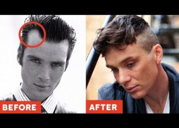 11 GENIUS Hairstyles TO HIDE Receding Hairlines / Big Foreheads (2019 Styles ONLY)
