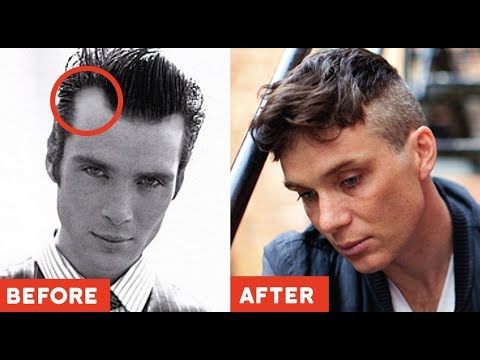 11 GENIUS Hairstyles TO HIDE Receding Hairlines / Big Foreheads (2019