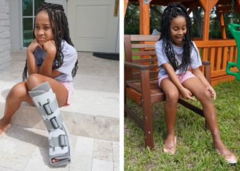 Girl with BROKEN LEG Finally Gets Her HAPPINESS BACK | FamousTubeFamily